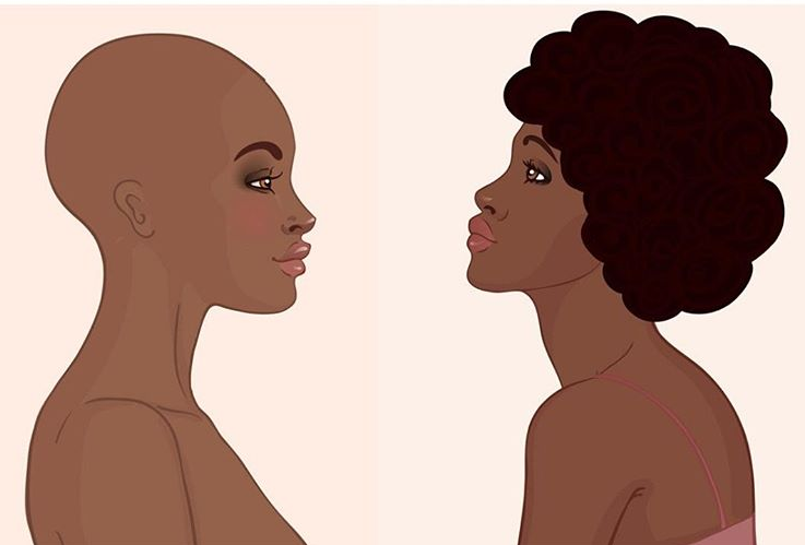 Hair loss in black women