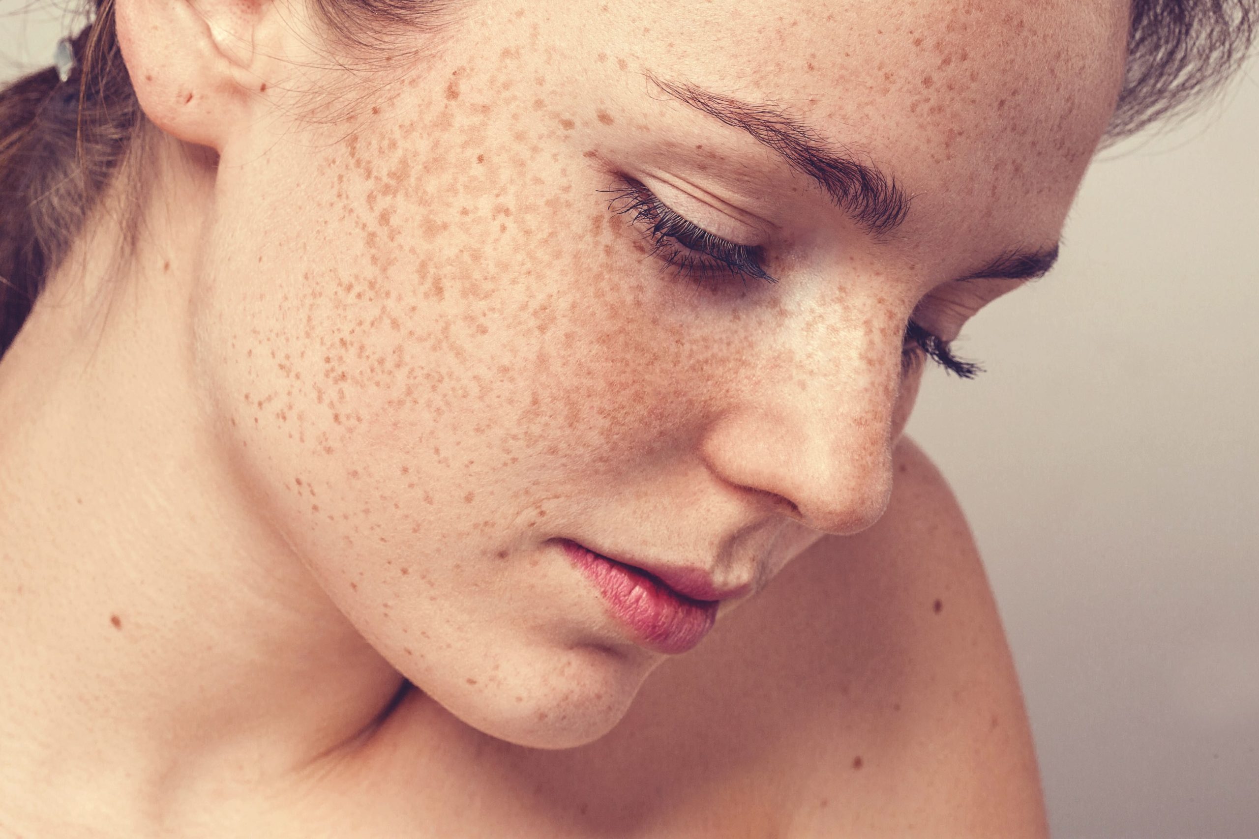 Woman with Freckles