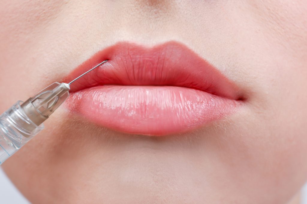 lip augmentation