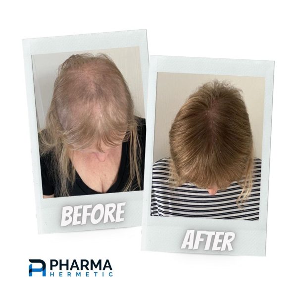 Pharma Hermetic Hair Recovery Programme