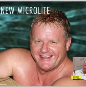 microlite - mens hair replacement system