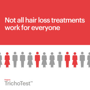 9. Not all hair loss treatments work for everyone