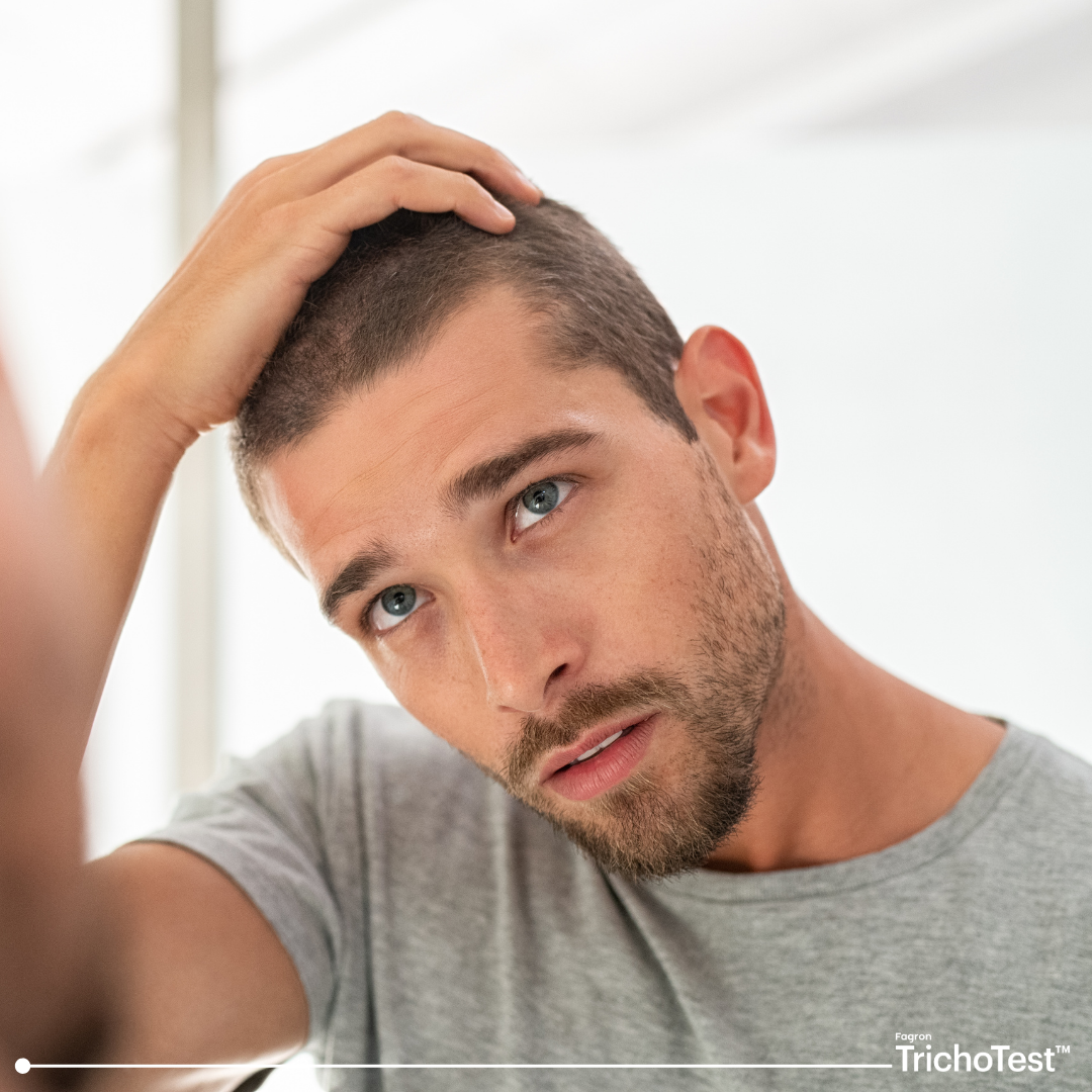 Thinking about a hair transplant?