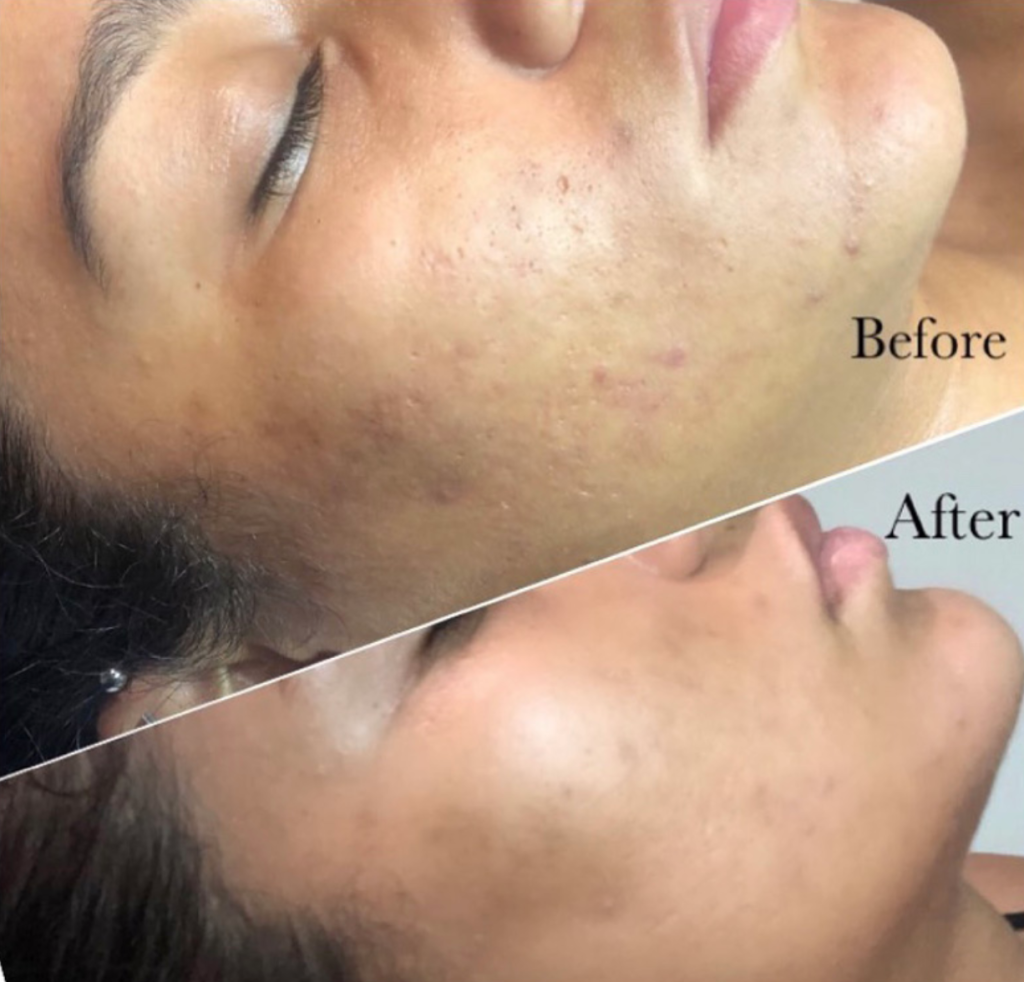 Dark spots and blemishes