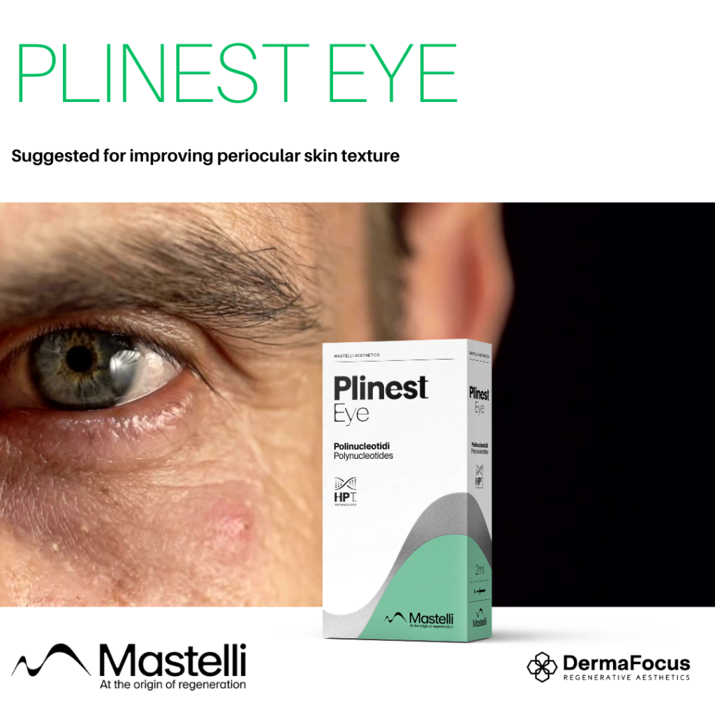 Plinest Eye (4) (3)