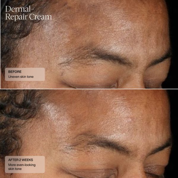 Dermal Repair Cream- before and after