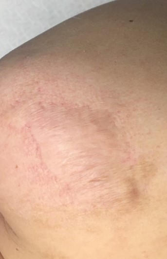 CDL-6months