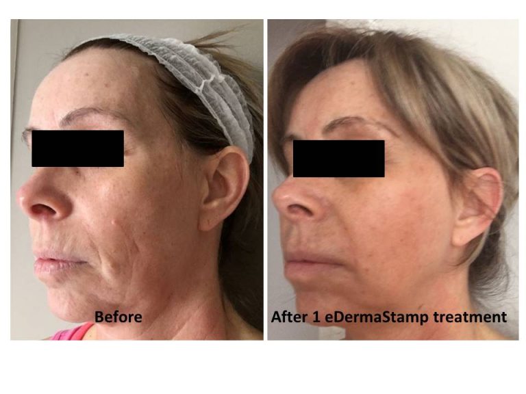 Ellen b&a 1