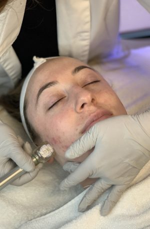 Cleopatra Hydrodermabrasion