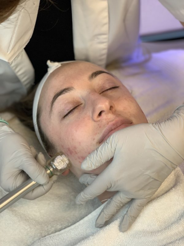 Cleopatra Hydrodermabrasion