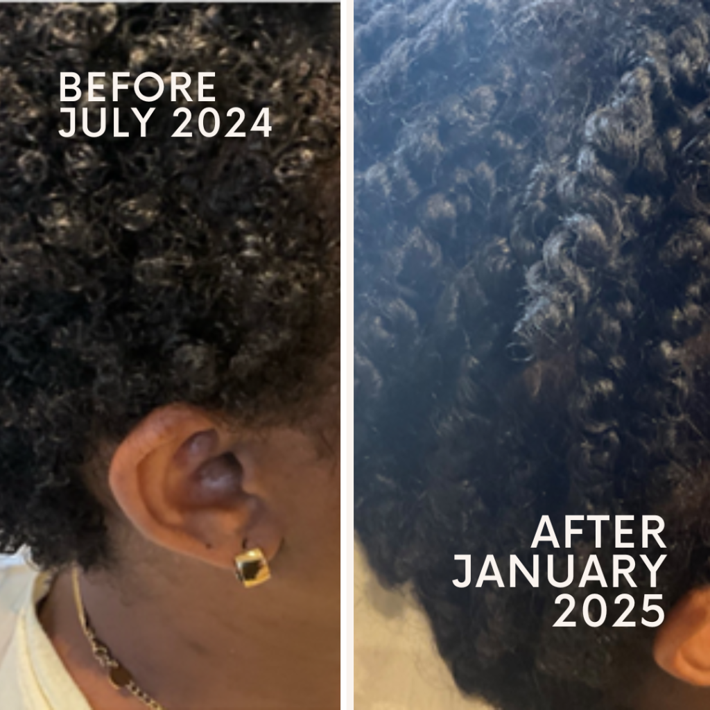 6 months after starting Pharma Hermetic