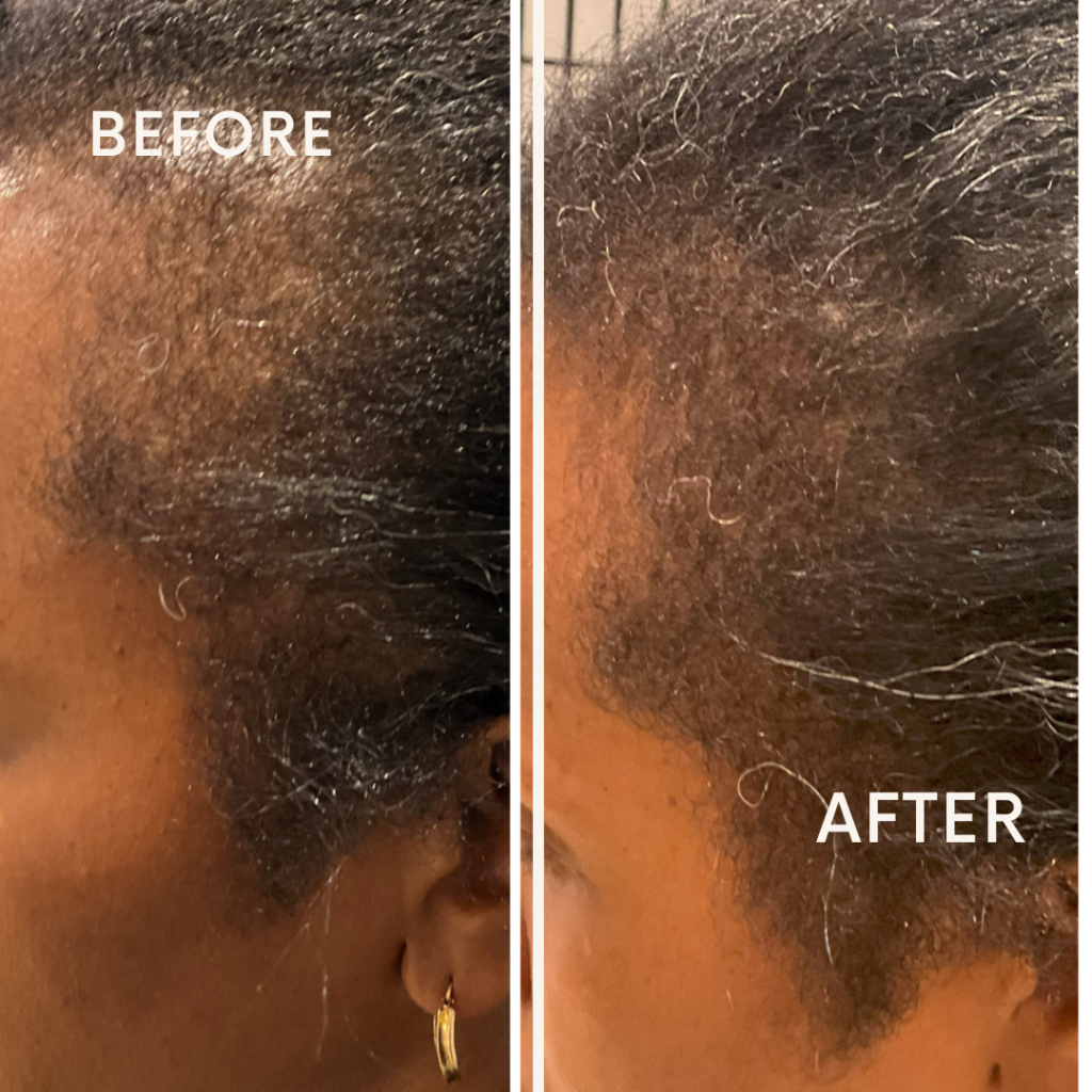 Before after minimal skincare Instagram post (1)