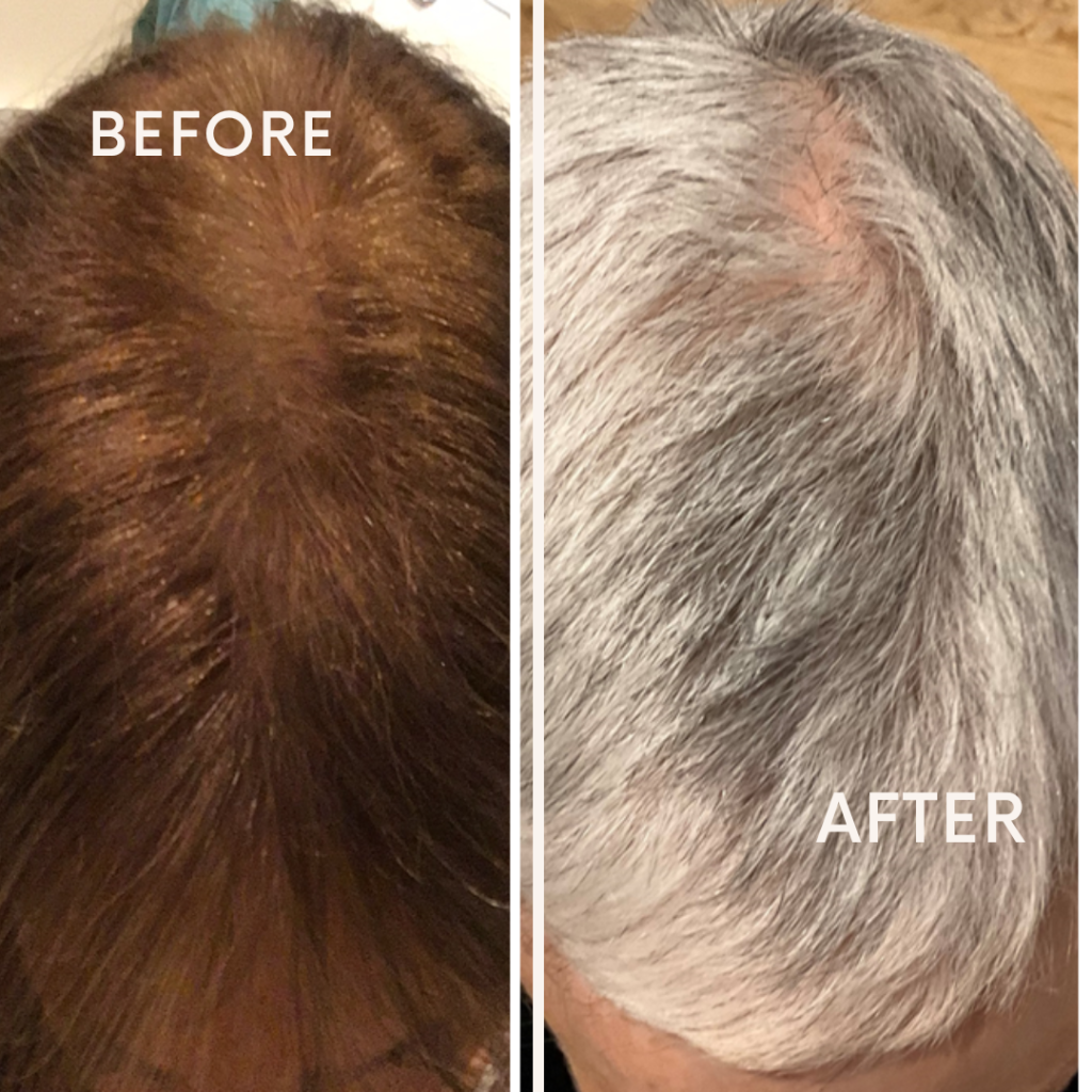 Before after minimal skincare Instagram post (12)