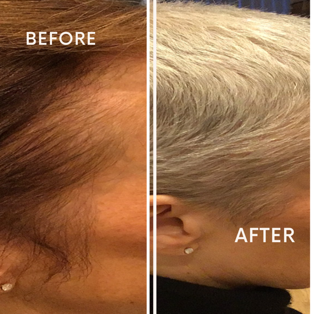 Before after minimal skincare Instagram post (13)
