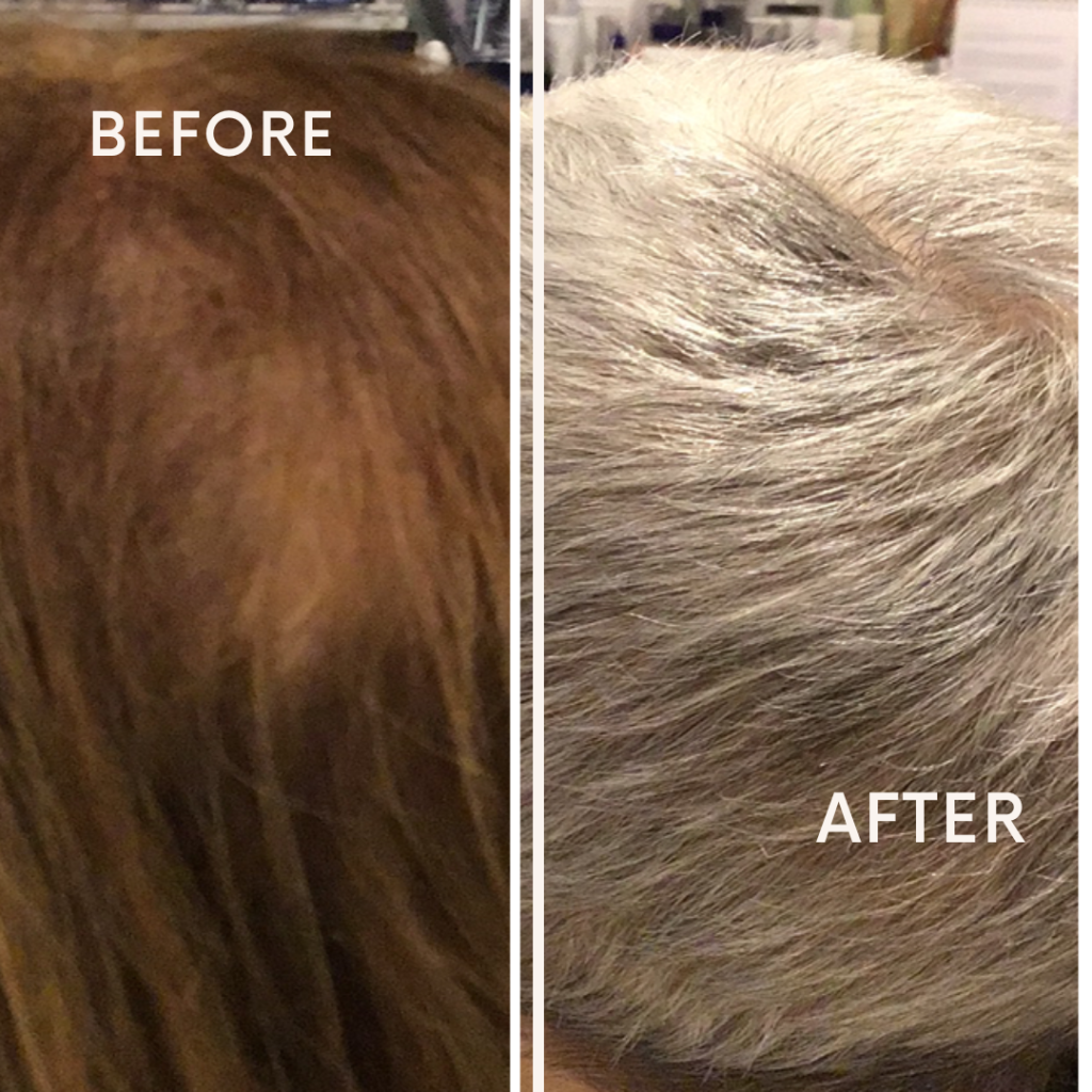 Before after minimal skincare Instagram post (14)