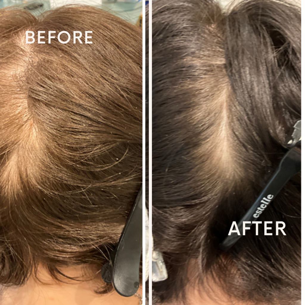 Before after minimal skincare Instagram post (4)