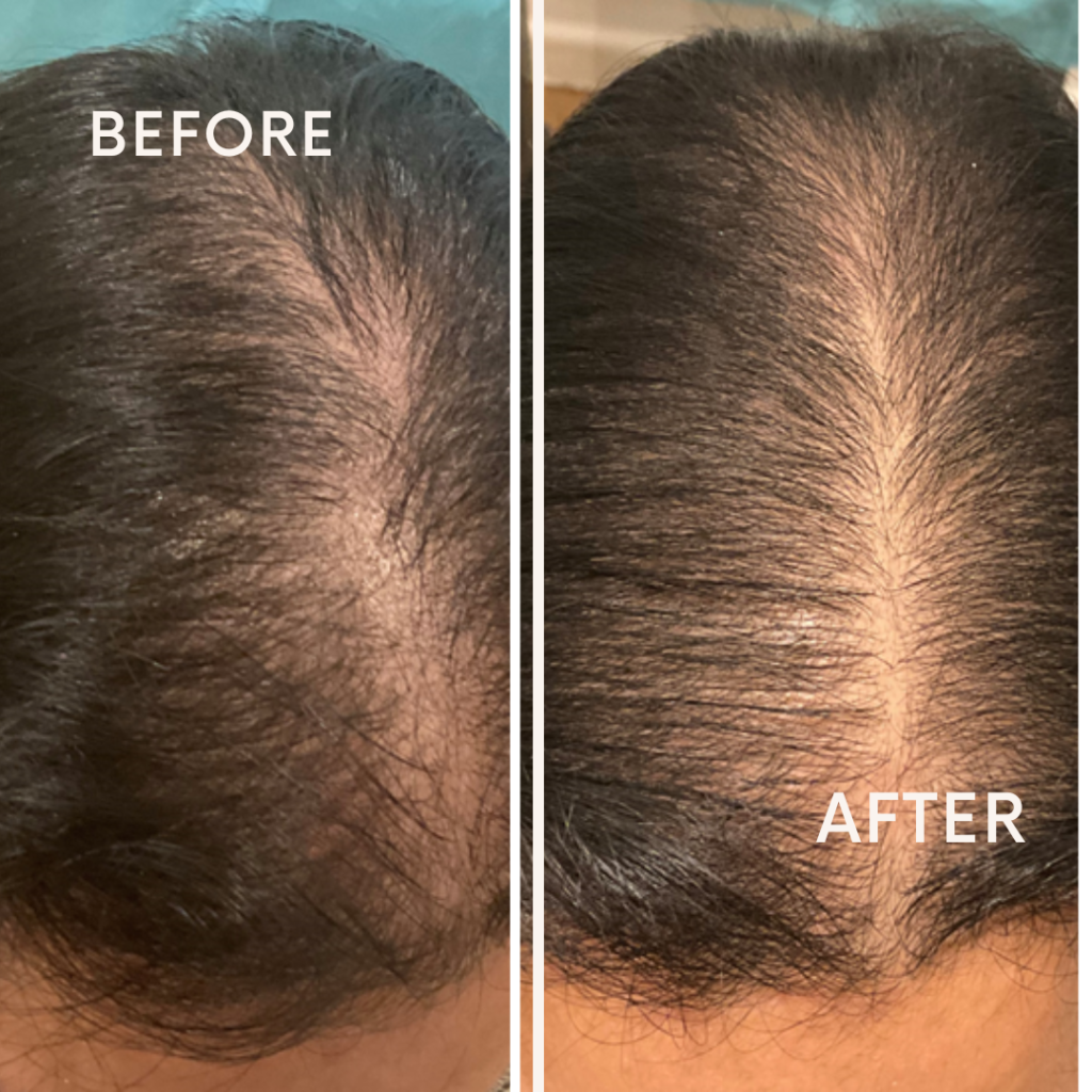 Before after minimal skincare Instagram post (5)