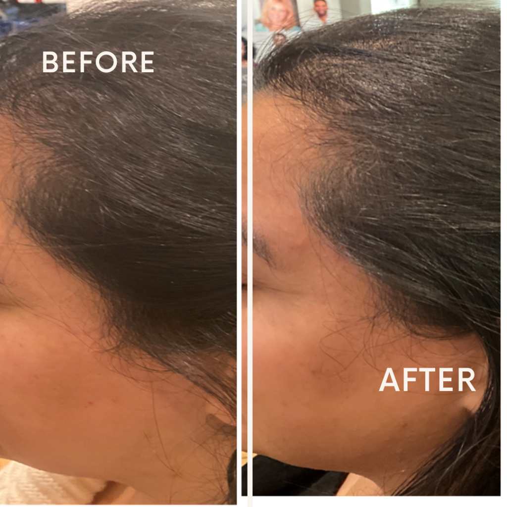 Before after minimal skincare Instagram post (6)