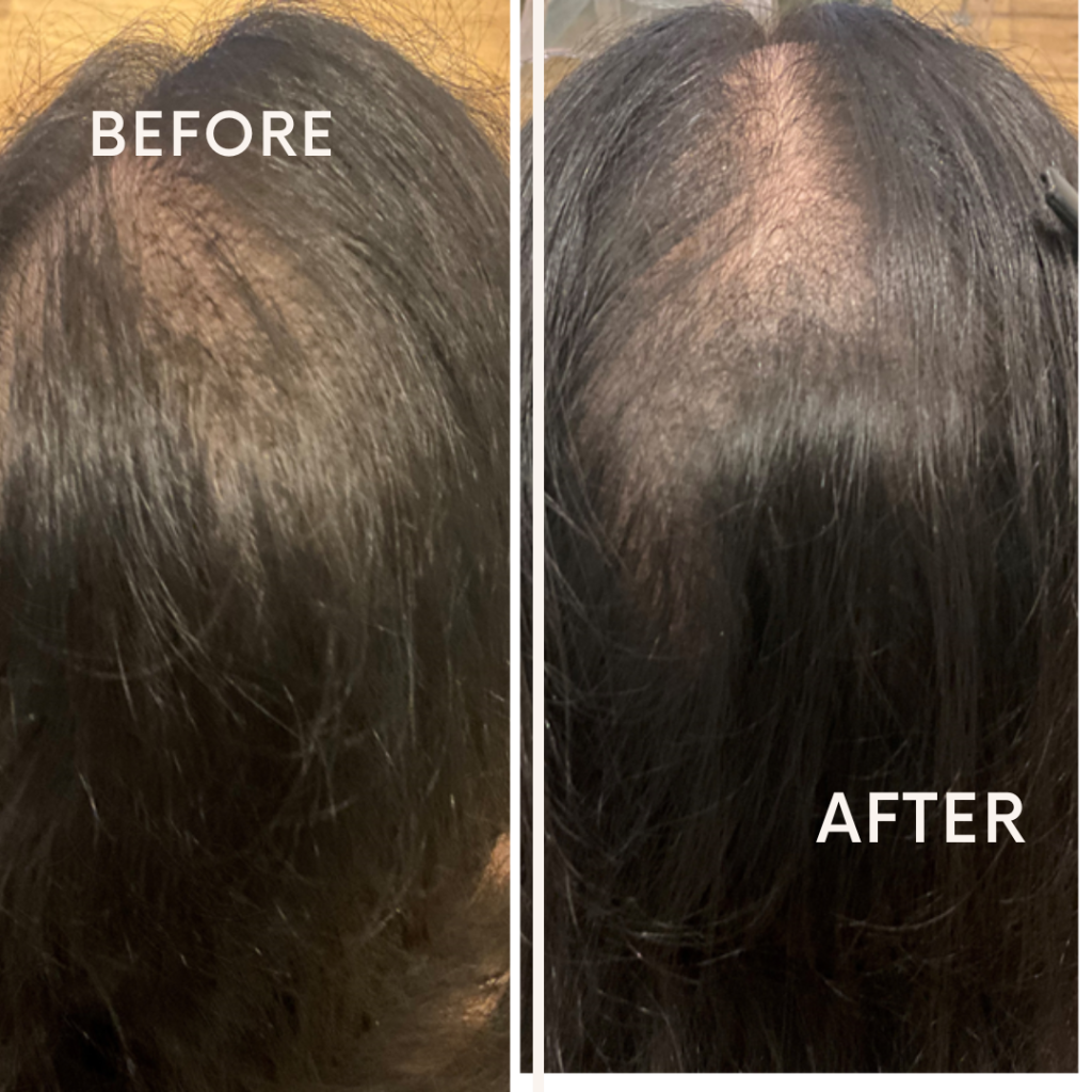 Before after minimal skincare Instagram post (7)
