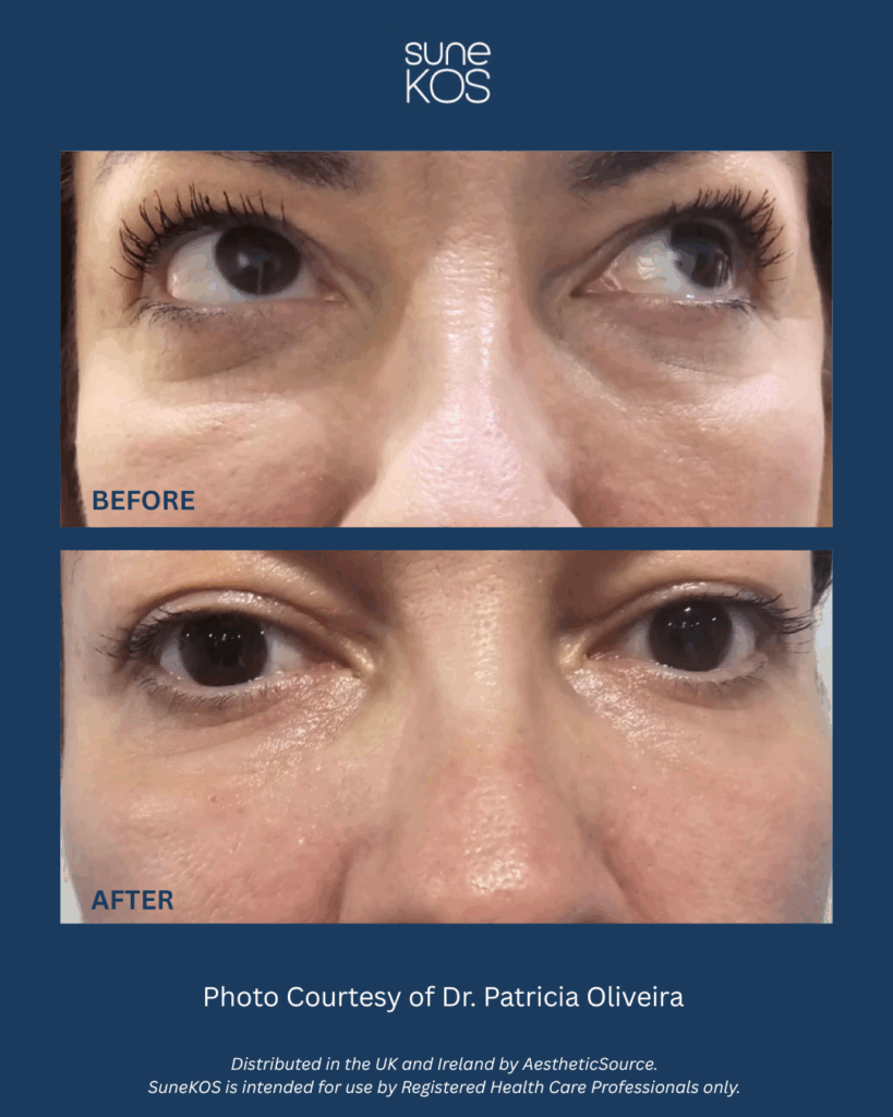 SuneKOS B&A 3 (1)