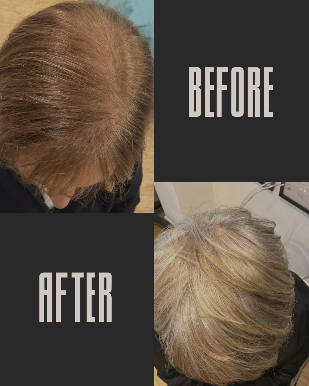 One year after Pharma Hermetic treatment programme