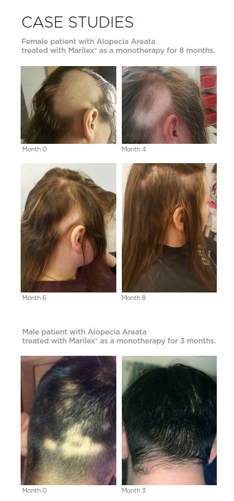 Nourkrin case studies