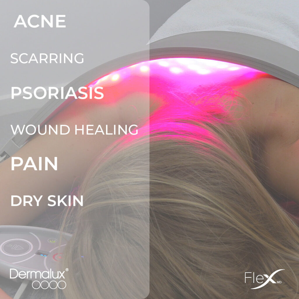 Conditions for light treatment