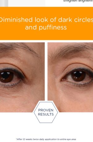 Enlighten eye before and after 12 weeks