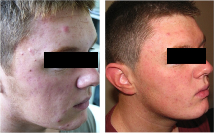 Spots Before and After 2