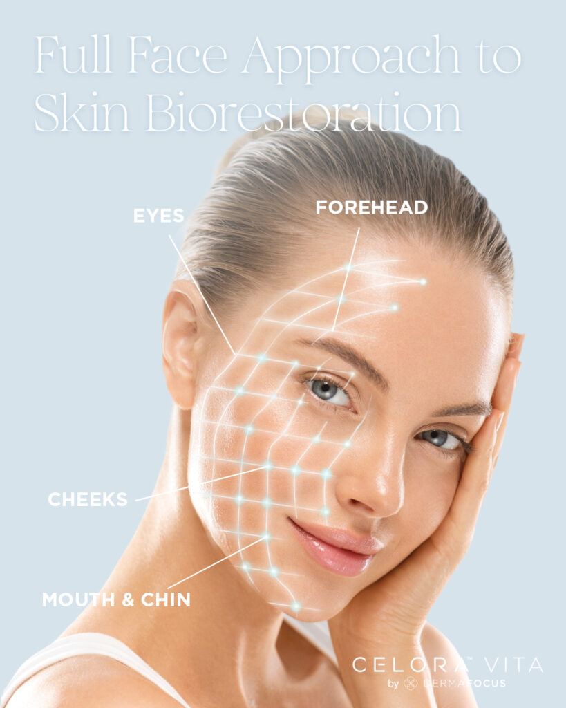Promotional graphic titled "Full Face Approach to Skin Biorestoration." It features a close-up of a woman with smooth, glowing skin, looking at the camera while gently resting her cheek in her hand. Overlaid on the right side of her face is a glowing white, curved grid pattern with highlighted nodes. White labels point to different areas of the grid: "FOREHEAD," "EYES," "CHEEK," and "MOUTH & CHIN." The bottom right corner features the branding "CELORA™ VITA by DERMAFOCUS